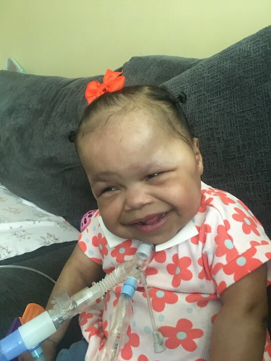 Baby Devyn is sitting on a couch and wearing a big smile, small coral bow, and a shirt with coral and turquoise flowers. Her trach is prominently displayed in the image.